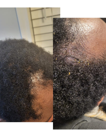 HERBAL INFUSED MAGIC HAIR GROWTH OIL